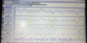 2 nowe sondy pozostałe.jpg